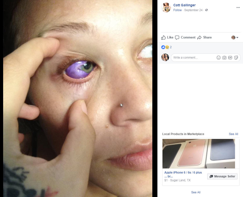 Eyeball Tattoos: Everything You Need to Know | Tattooing 101