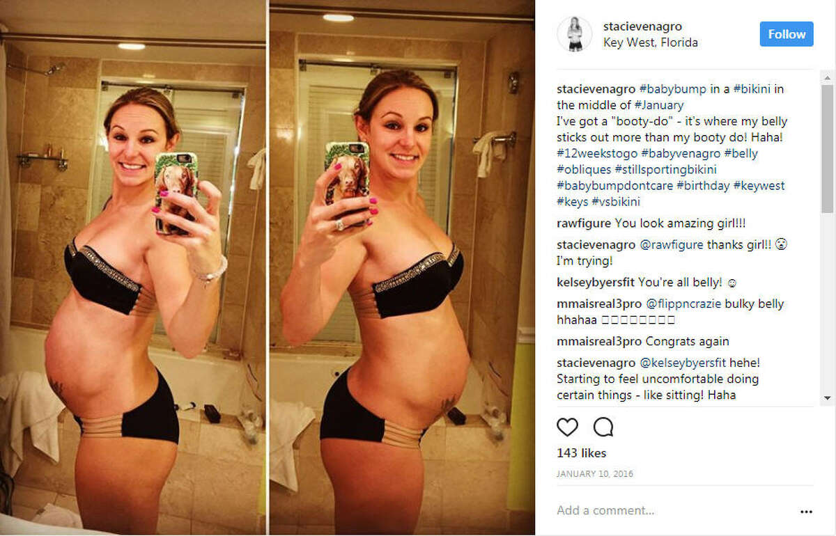 Photo Texas Mom Bares Belly On Facebook One Week After Giving Birth