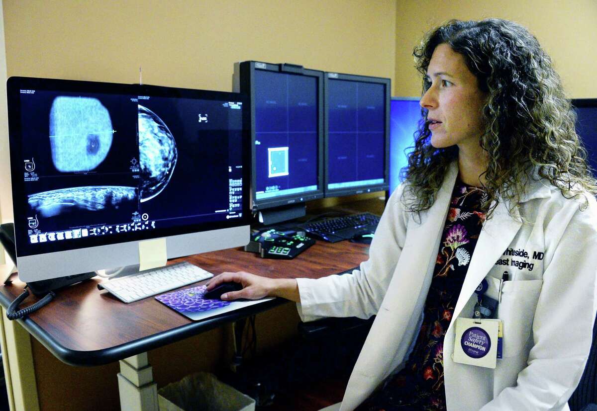 Radiologist Dr. Beth Whiteside reads a mammogram from their new automated ultrasound machine in the reading room at Albany Medical Center's South Clinical Campus Wednesday Oct. 11, 2017 in Albany, NY. (John Carl D'Annibale / Times Union)