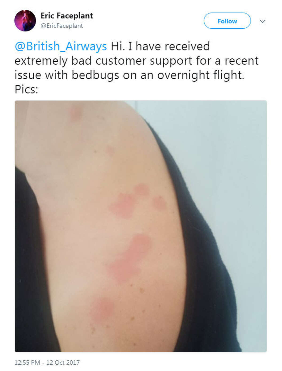 British Airways is under fire after passengers complained of being attacked by bed bugs during an overnight flight.  Photo: Eric Neilsen Twitter