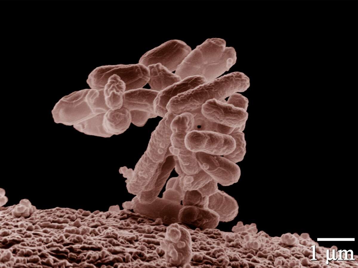 Low-temperature electron micrograph of a cluster of E. coli bacteria. 