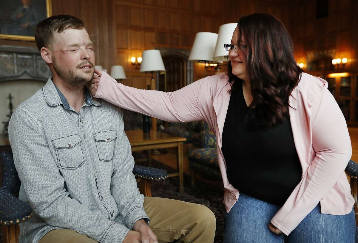 Lilly Ross, right, feels the beard of face transplant recipient Andy Sandness during their meeting at the Mayo Clinic, Friday, Oct. 27, 2017, in Rochester, Minn. Sixteen months after surgery gave Sandness the face that once belonged to Calen "Rudy" Ross, Sandness met the woman who had agreed to donate her high school sweetheart's face to him, who lived nearly a decade without one. (AP Photo/Charlie Neibergall)