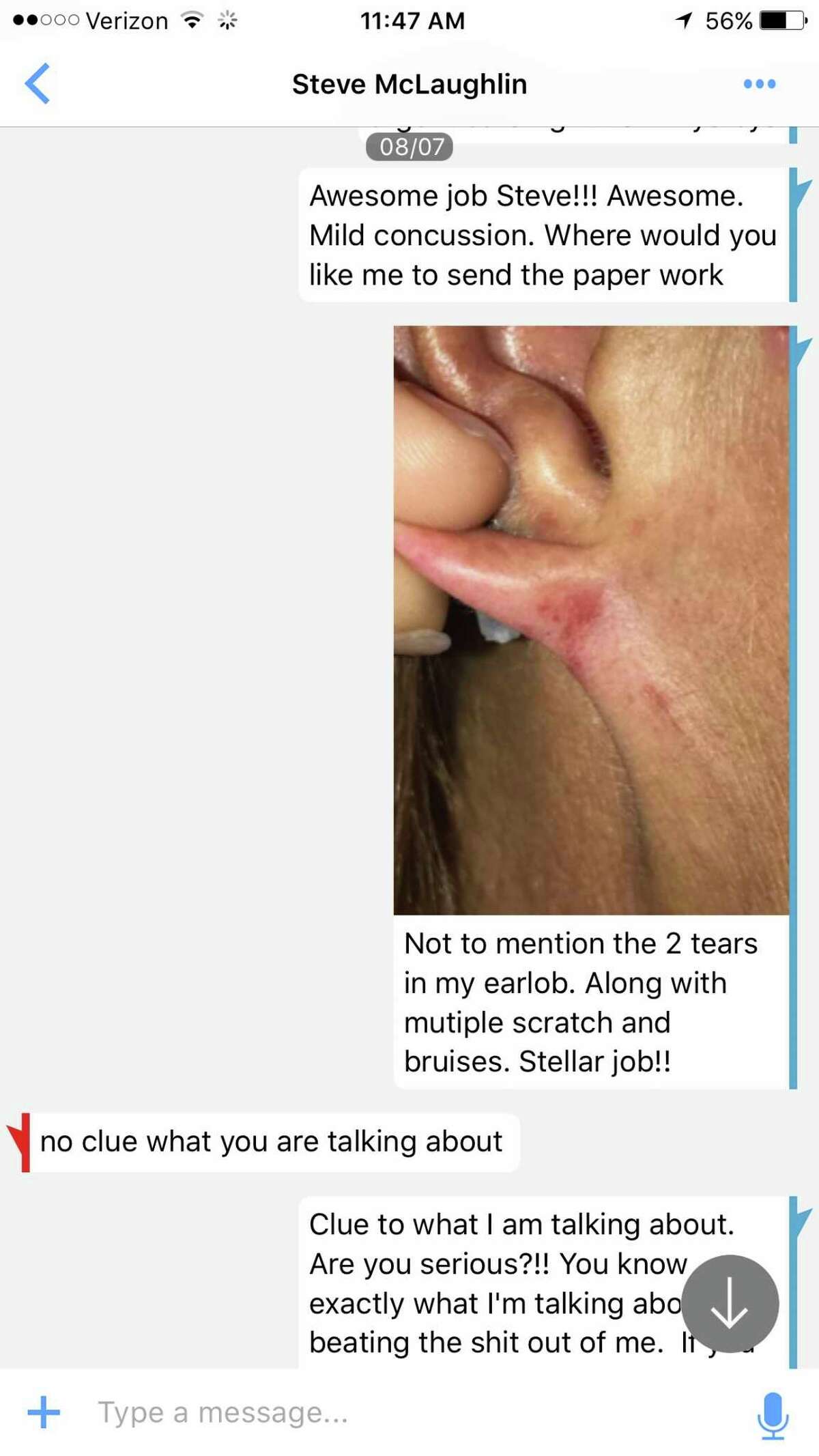 A screenshot of a text message exchange between Assemblyman Steve McLaughlin and his former aid after an alleged physical assault.