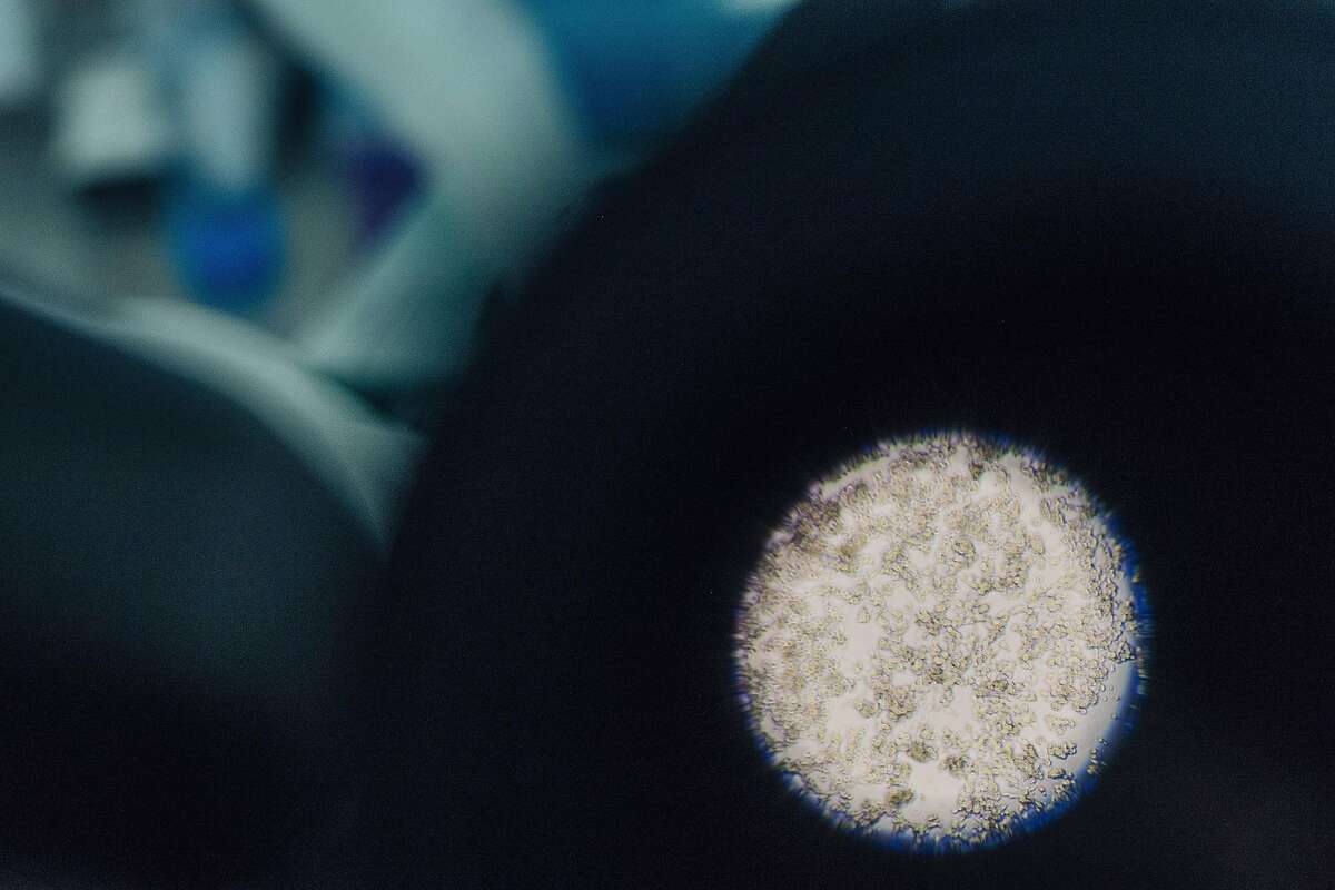 Cancer cells seen through a microscope in a cell culture laboratory at I-Mab Biopharma in Shanghai, Dec. 12, 2017. A growing number of Chinese pharmaceutical companies are trying to break into the United States, seeking regulatory approval to offer their treatments for cancer and other ailments. (Yuyang Liu/The New York Times)