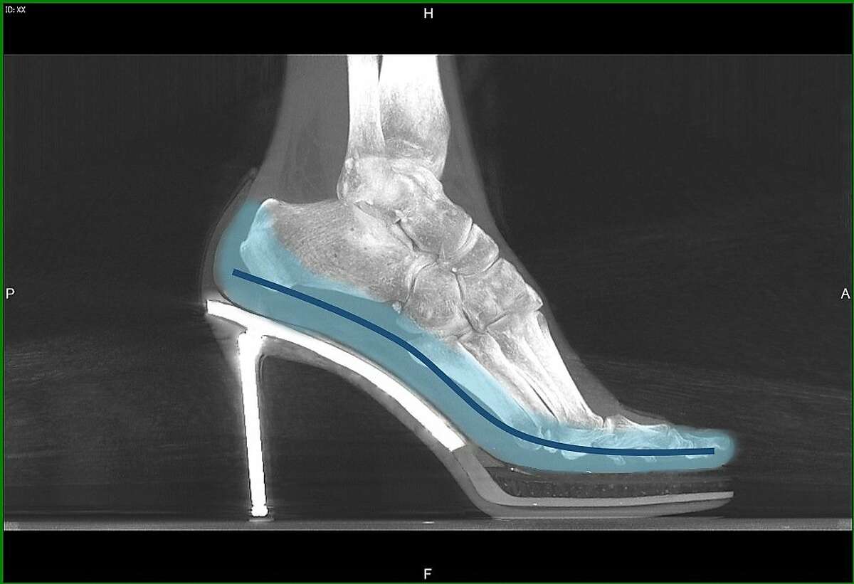 Los Gatos podiatrist Dr. Joan Oloff's line of fashionable shoes for women are designed with medical sensibilities in mind, including metatarsal supports and built-in arches. These X-ray images show a woman's foot in a regular pump and another woman's foot in a pump designed by Oloff. The red line shows the bottom of the foot and the toe crimping that occurs without proper arch support or center-of-gravity stabilization. In the Oloff shoe, there is a hidden inner platform and a section under the ball of the foot that is cut out, with cushioning below it, while the wearer's heel is set back farther in the shoe for better stabilization when walking.