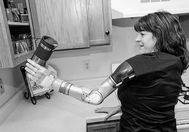 Army veteran grateful for donated bionic arm
