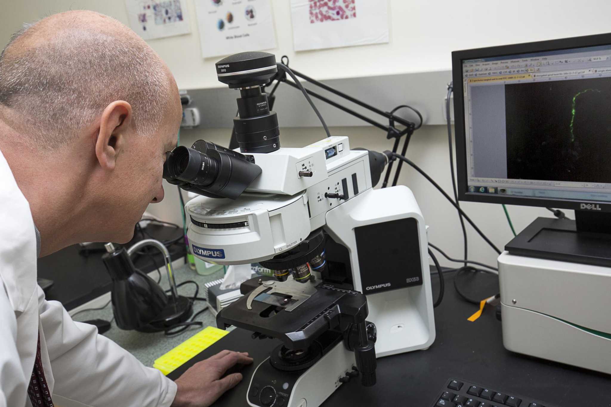 Spirochaetes Examples Lyme researchers hone diagnostic tools