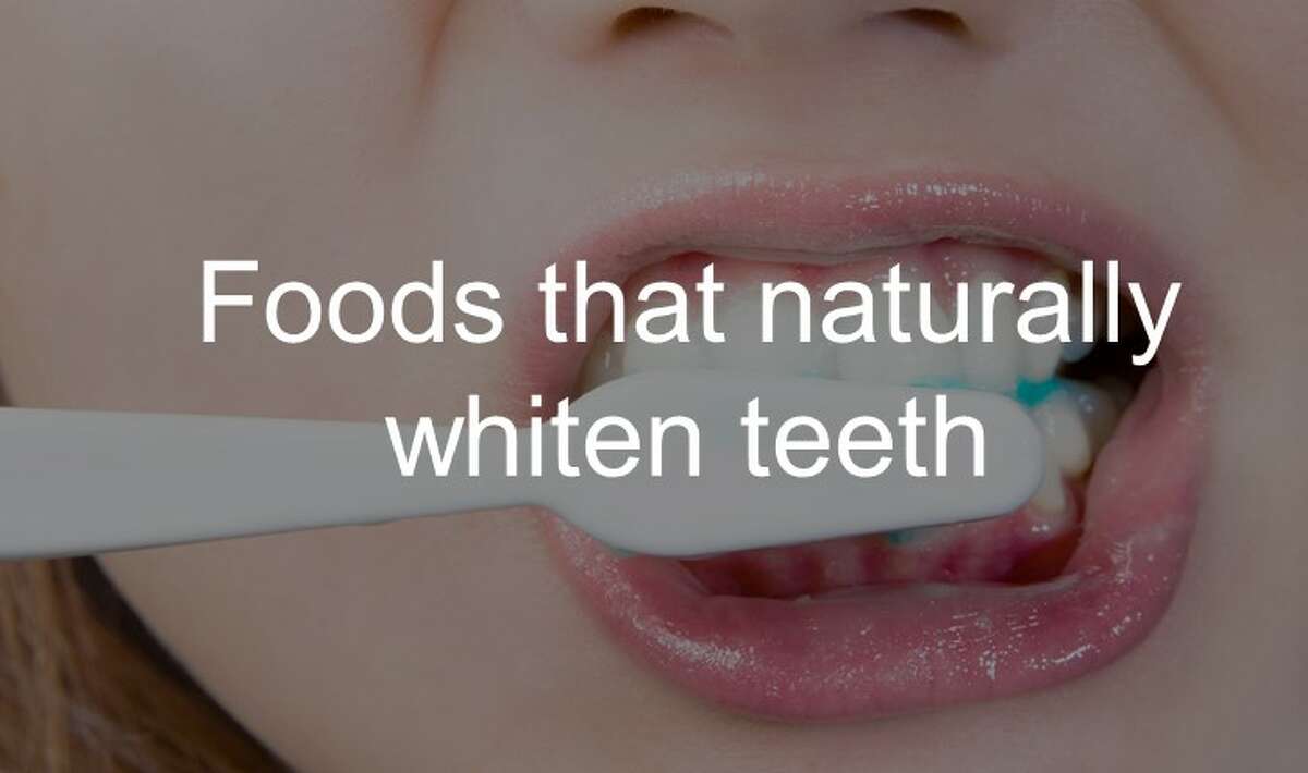 Scroll ahead to see foods that naturally whiten teeth.