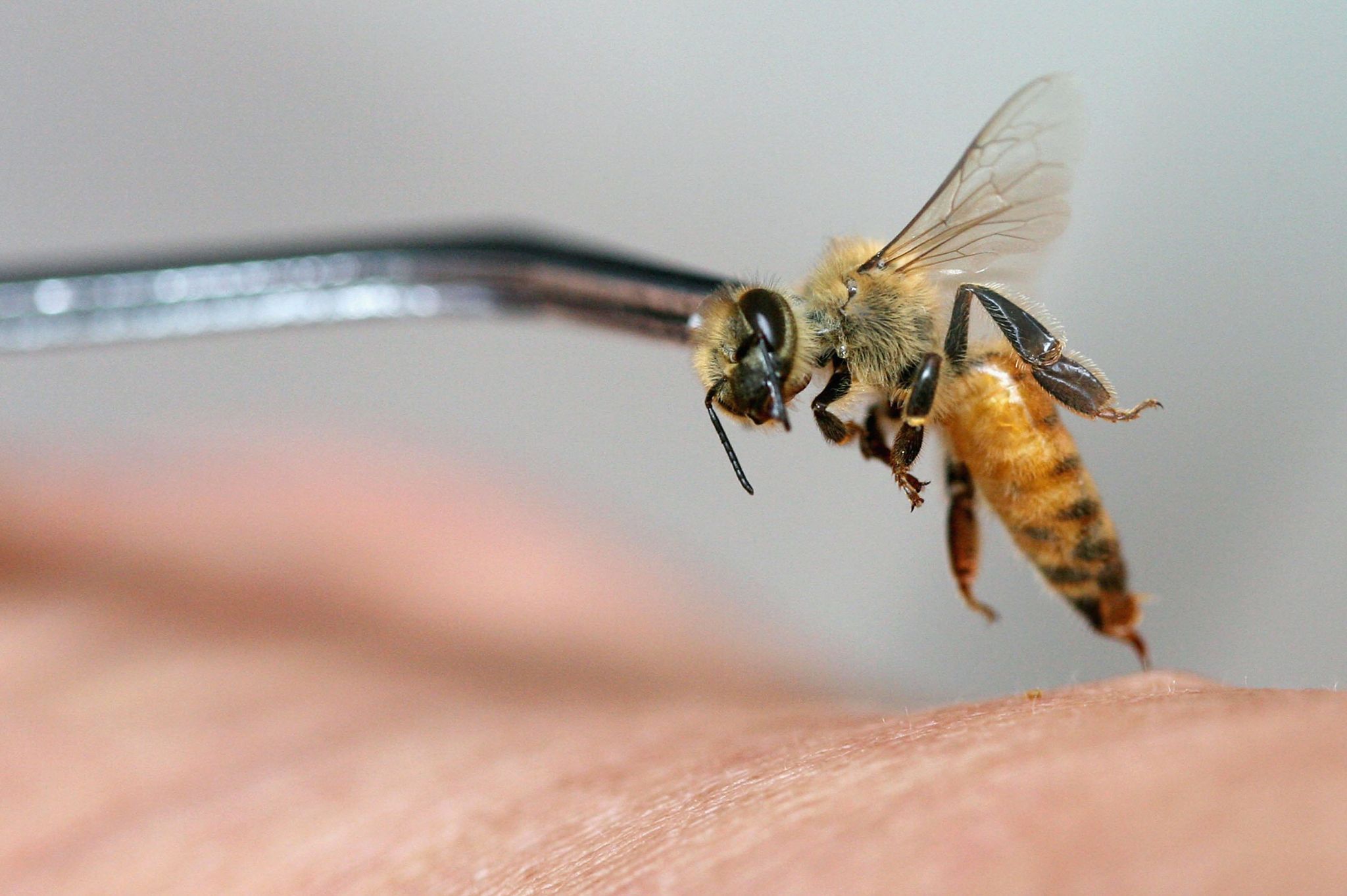 Woman dies after undergoing 'bee acupuncture' treatment famously touted
