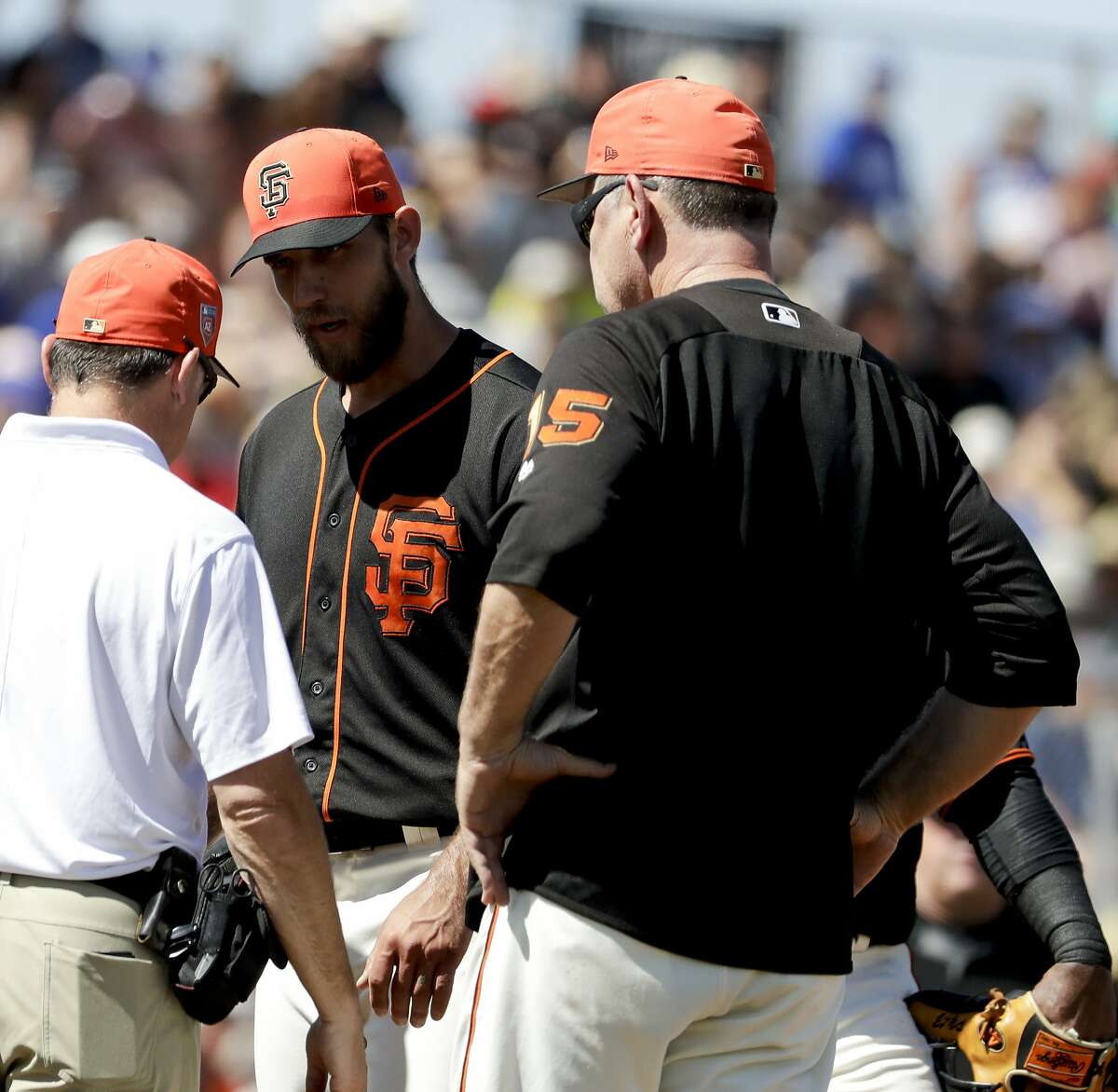 San Francisco Giants starting pitcher Madison Bumgarner, center, is looked over by manager Bruce Bochy, right, and a trainer after getting hit in the arm by a batted ball during the third inning of a spring baseball game against the Kansas City Royals in Scottsdale, Ariz., Friday, March 23, 2018. (AP Photo/Chris Carlson)