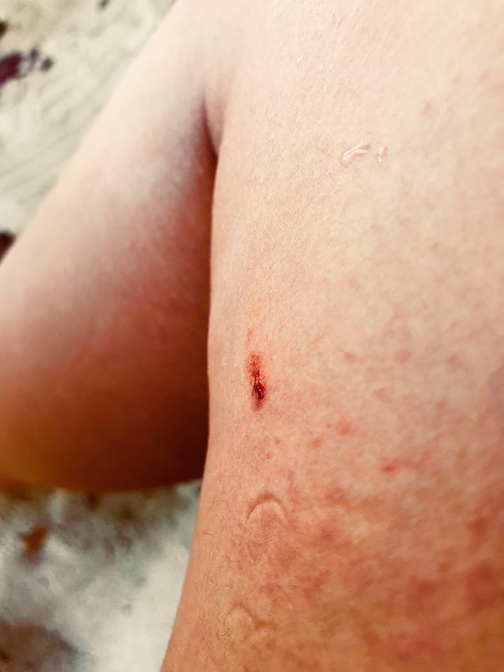 Bizarre tropical fish bite slightly wounds local TV anchor