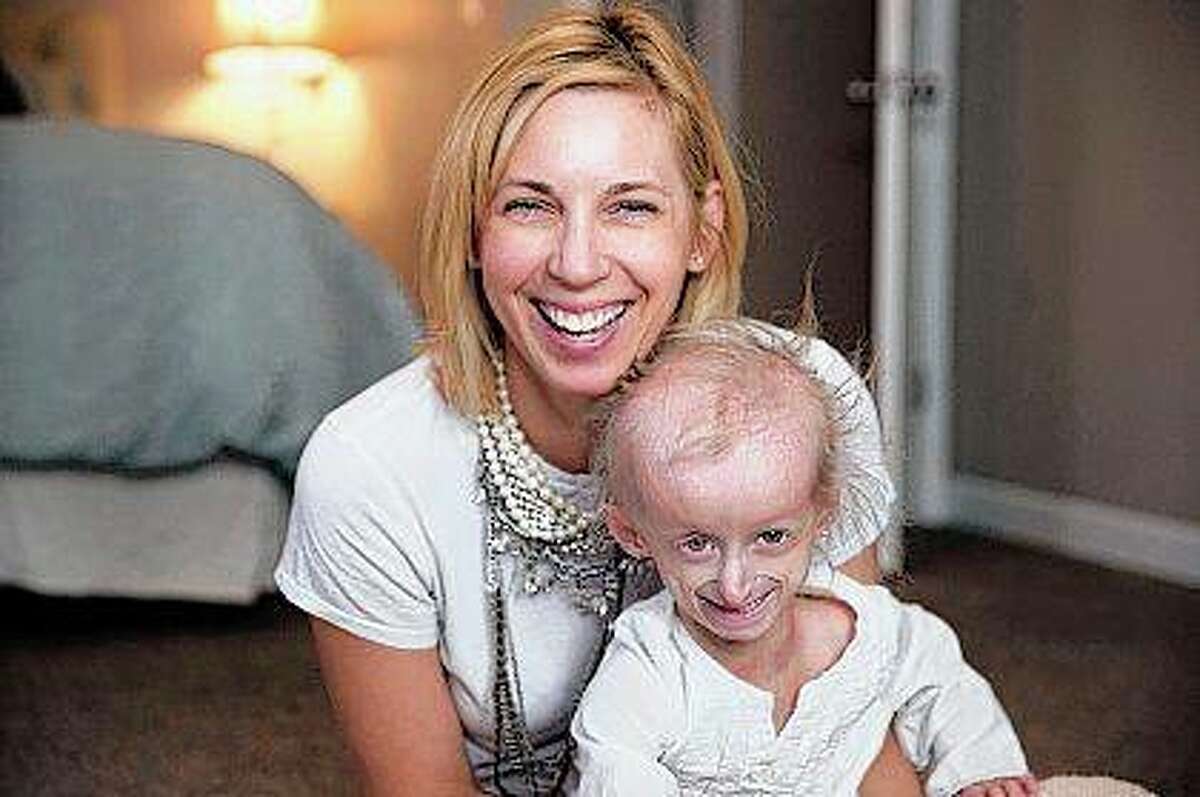 Carly Kudzia, 7, participated in a study suggesting that the drug lonafarnib may extend life for children with progeria, a rare, incurable disease that causes rapid aging. Other kids “always think I’m a baby,” Carly says. But “I’m a regular kid.” She is with her mother, Heather Unsinger.