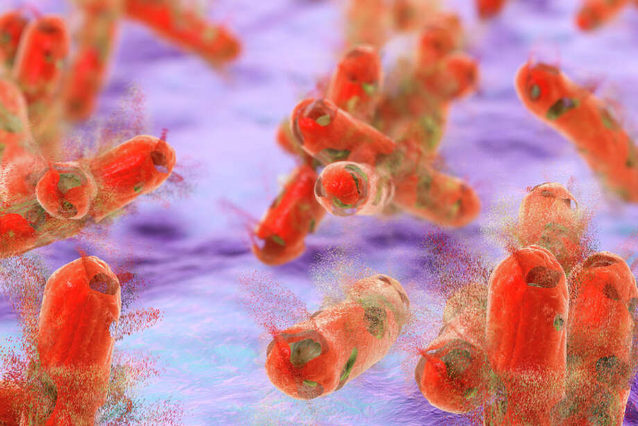 >>Things you need to know about the threat of tuberculosis
 Photo: KATERYNA KON/SCIENCE PHOTO LIBRARY/Getty Images/Science Photo Library RF