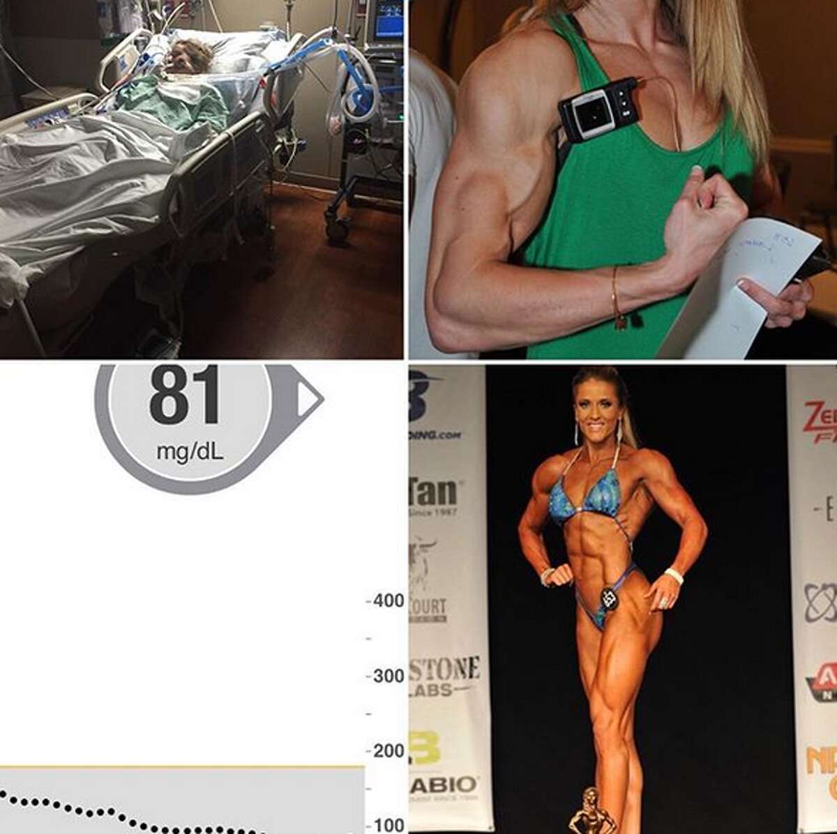 Lauren Howe, 31, is a San Antonio resident with Type 1 diabetes who is making strides in her bodybuilding goals.