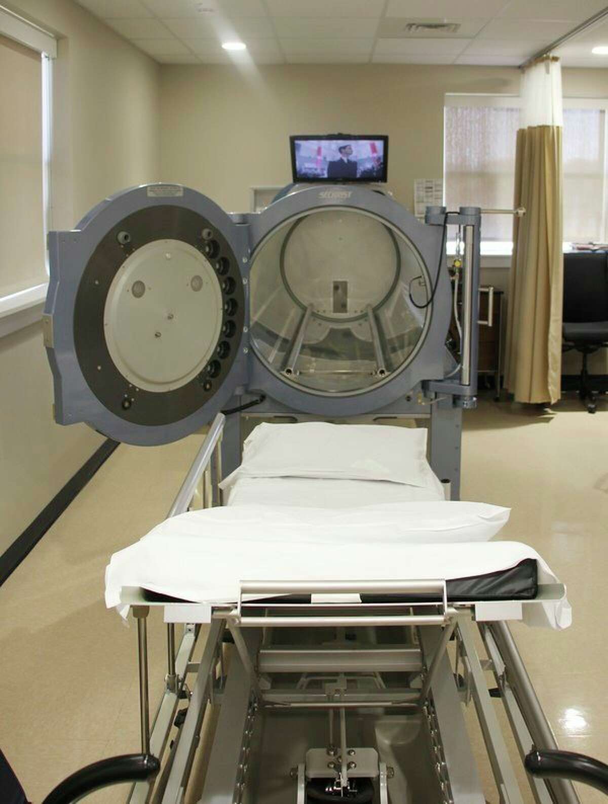 This hyperbaric oxygen treatment machine at McLaren Thumb Region is for patients who need advanced treatment. The treatment is for patients who have an infected bone or a diabetic foot ulcer with exposed bone tendon that's infected. (Bradley Massman/Huron Daily Tribune)