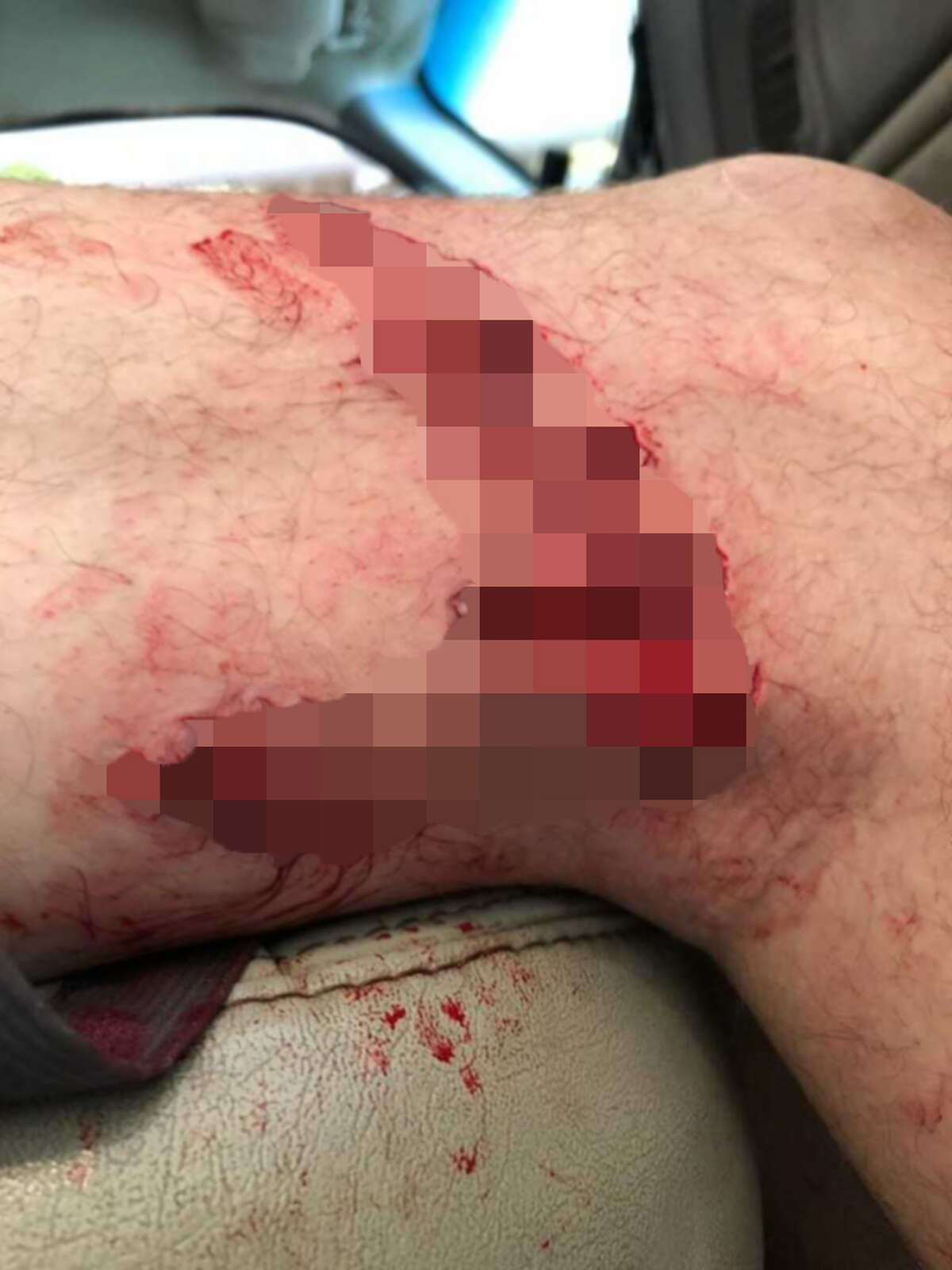 A 42-year old man was bitten by a shark near Crystal Beach on Thursday, August 9, 2018. 