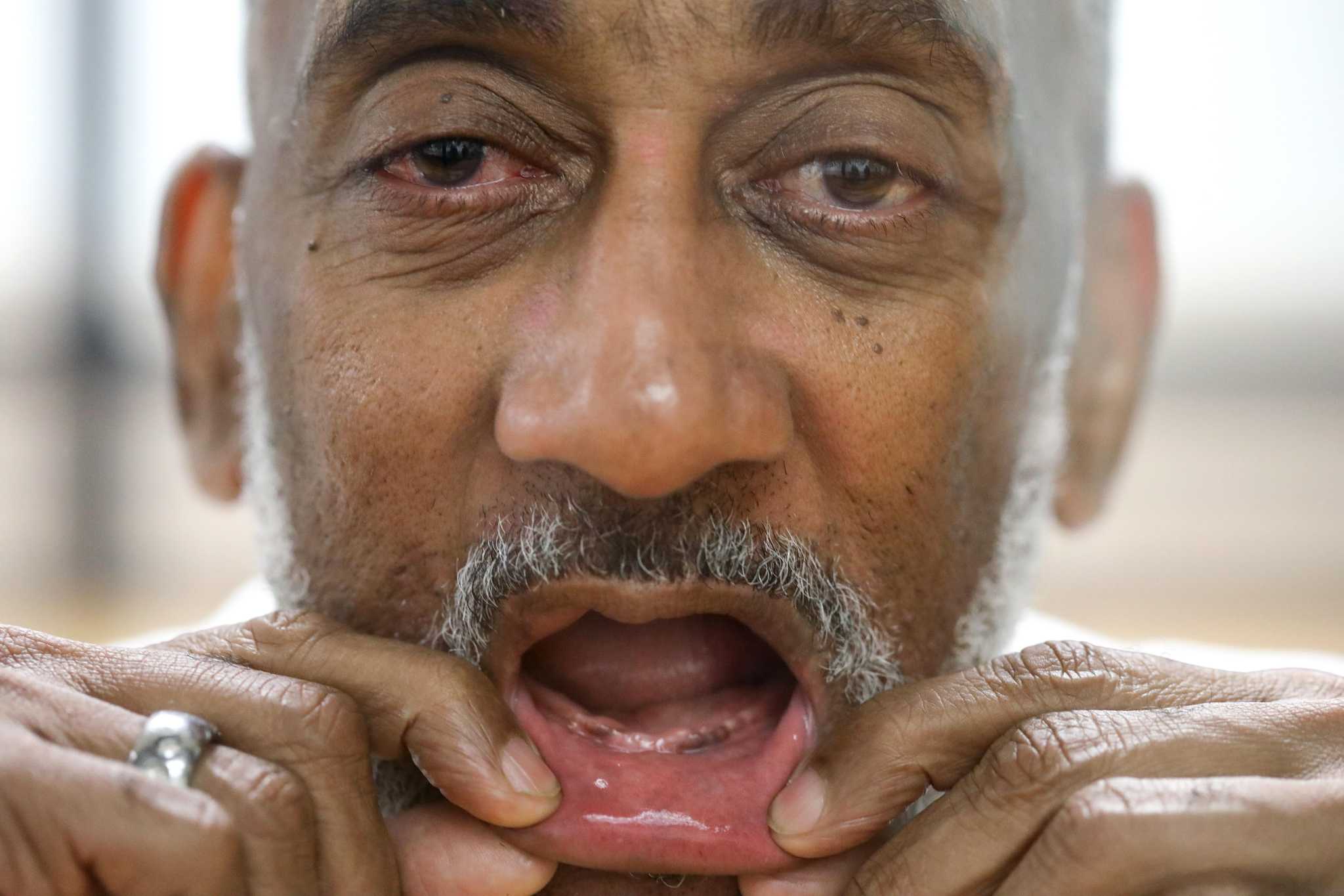 Toothless Texas inmates denied dentures in state prison