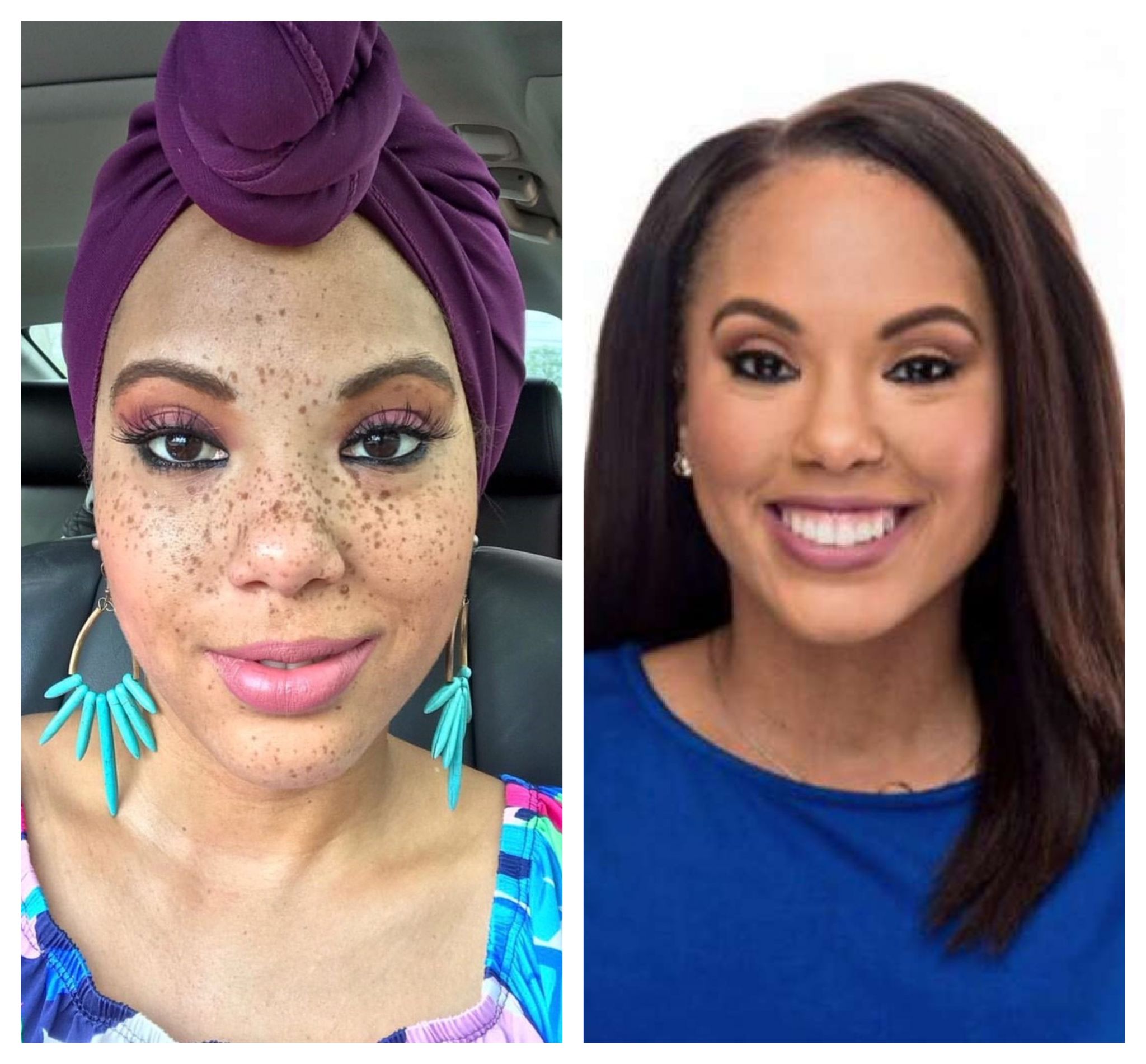 ABC 13 anchor 'frees' her freckles to show natural beauty