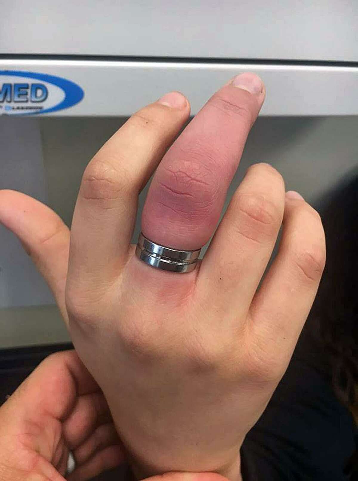 Bridgeport firefighters rescue finger from ring