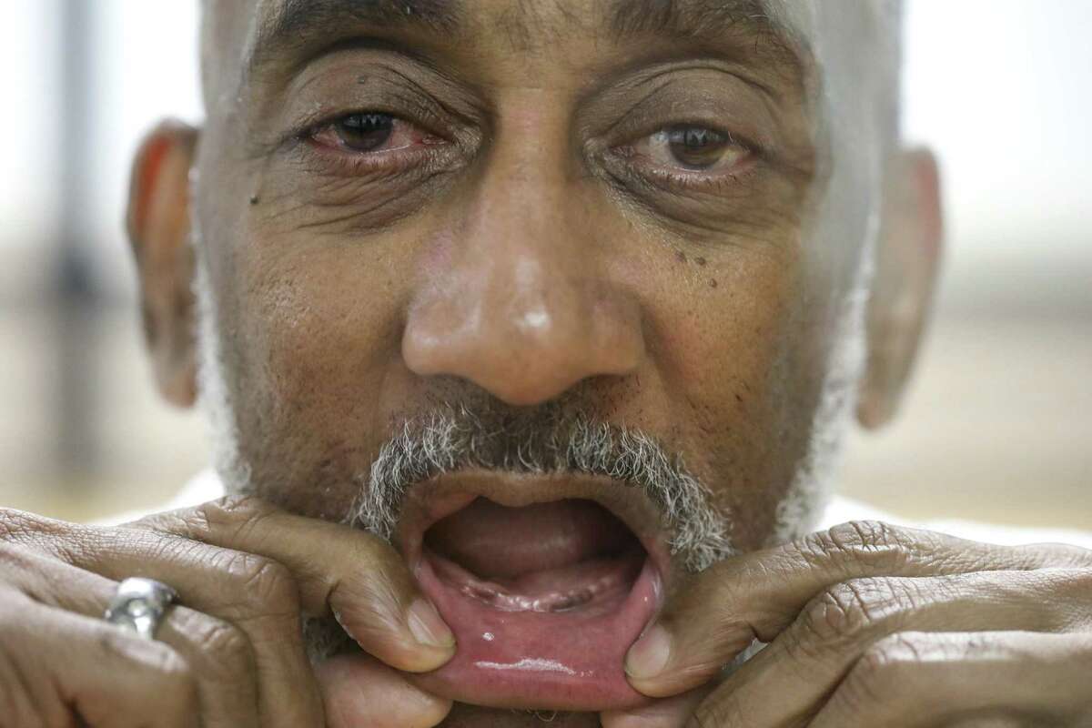 David Ford, an inmate at the Huntsville Unit who has had trouble getting dentures while in prison, shows his mouth while posing for a photo on Sept. 14, 2018 in Huntsville, Texas. Inmates without teeth in Texas are routinely denied dentures because state prison policy says chewing isn't a medical necessity and that they can eat blended food. The prison system is now in the process of getting Ford dentures.