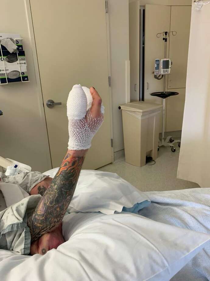 Ozzy Osbourne was hospitalized after an infection leading to surgery by hand Saturday morning, he said in a statement. Click on the gallery to read the original stories of iconic rock bands from the Bay Area. Photo courtesy of Ozzy Osbourne
