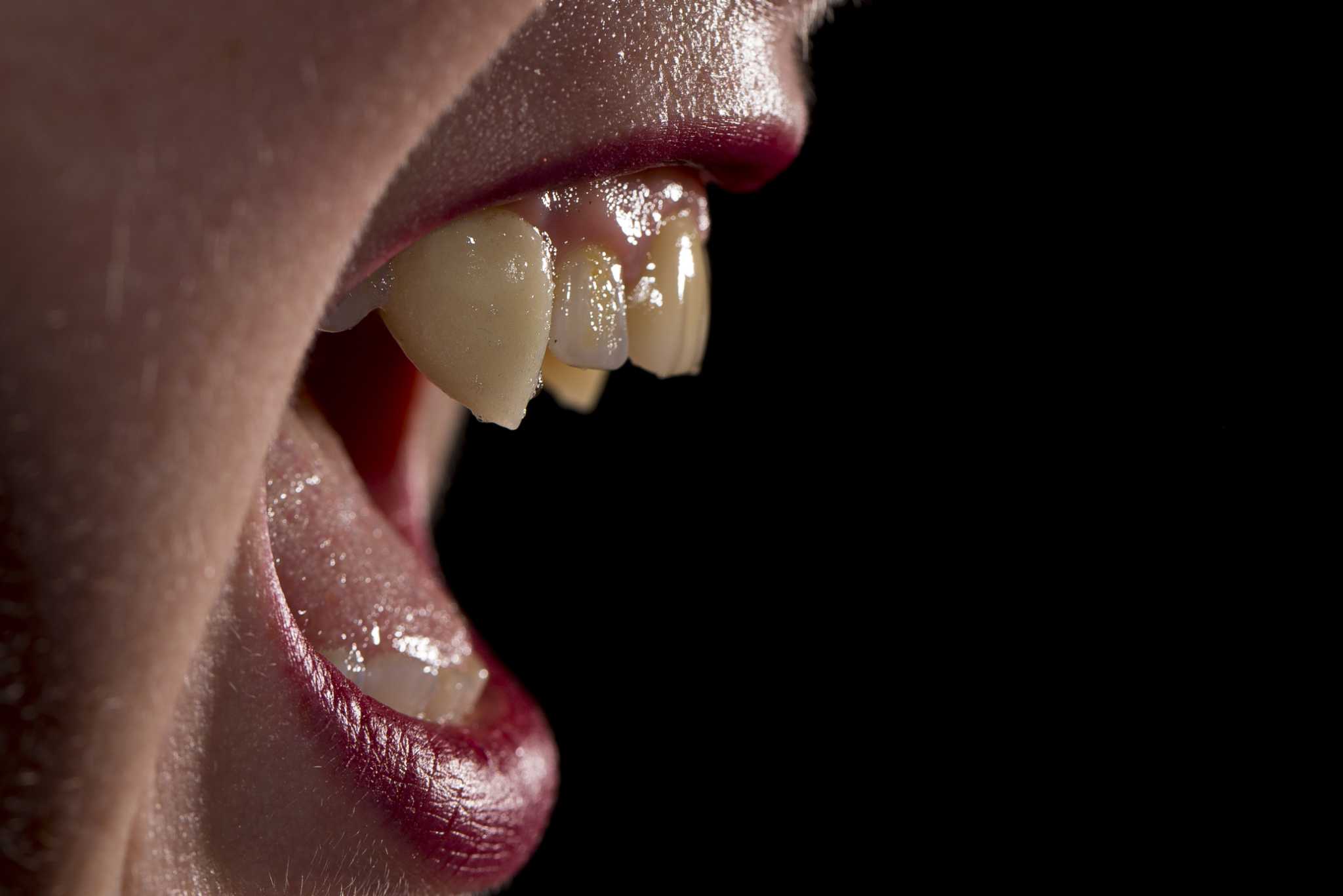 Need fangs delivered to your home? Houston’s fangsmith can do that.