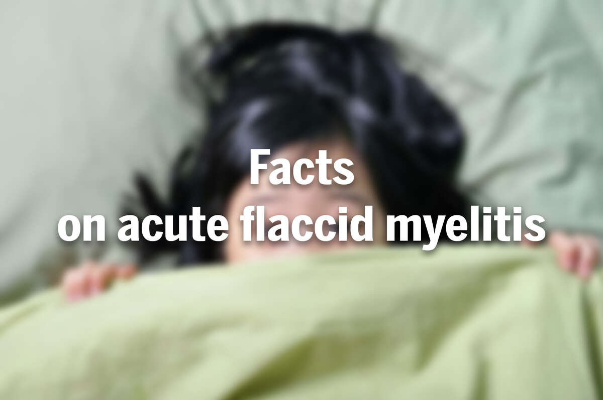 Facts on acute flaccid myelitis from the Centers for Disease Control.
