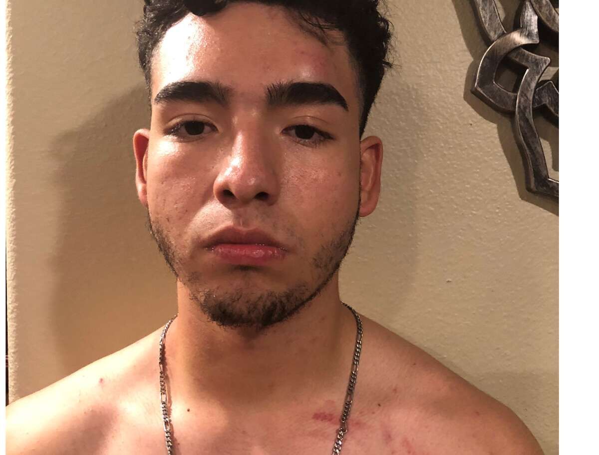 A teen allegedly beaten by an off-duty Baytown officer filed suit this week.