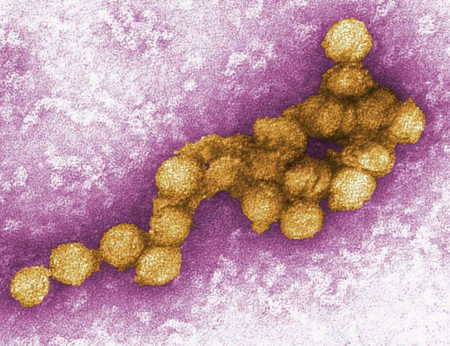 Electron Micrograph of West Nile Virus. The virus can infect humans, birds, mosquitoes, horses and some other mammals. According to state officials, Connecticut has experienced its most difficult season of all time for West Nile virus in 2018, with a record 22 human cases of mosquito-borne disease and one death from a resident of West Haven. Photo: Photographer: Cynthia Goldsmith / / Internal