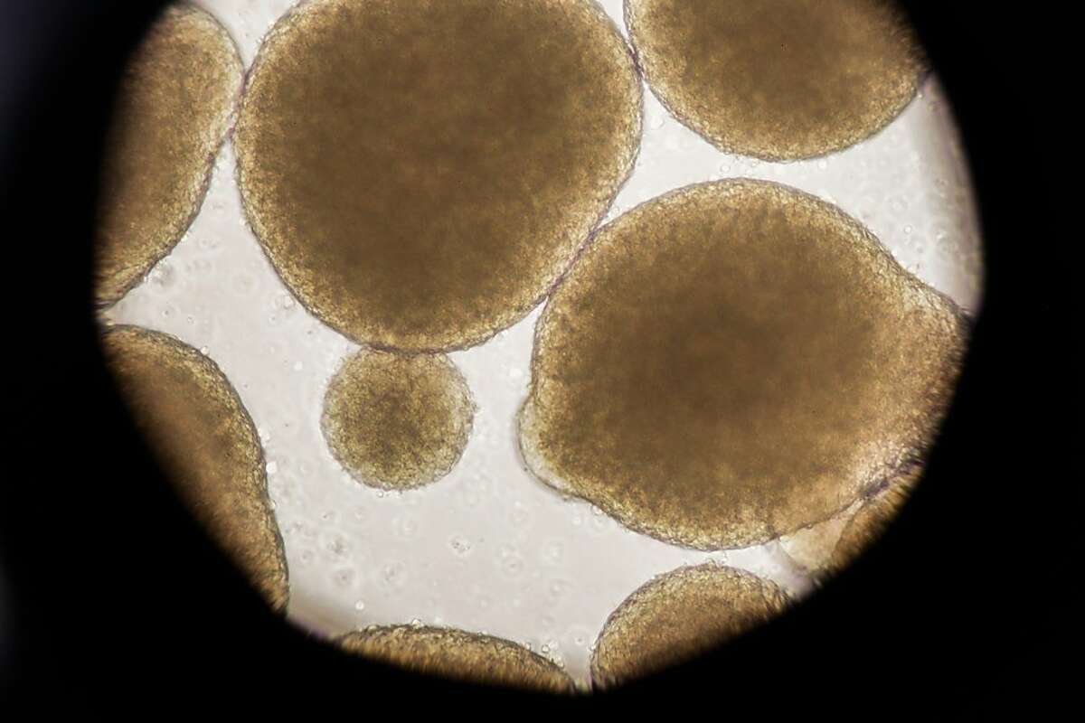 Stem cells are seen through a microscope at Asterias Biotherapeutics in Fremont, Calif., on Wednesday, Sept. 6, 2017.