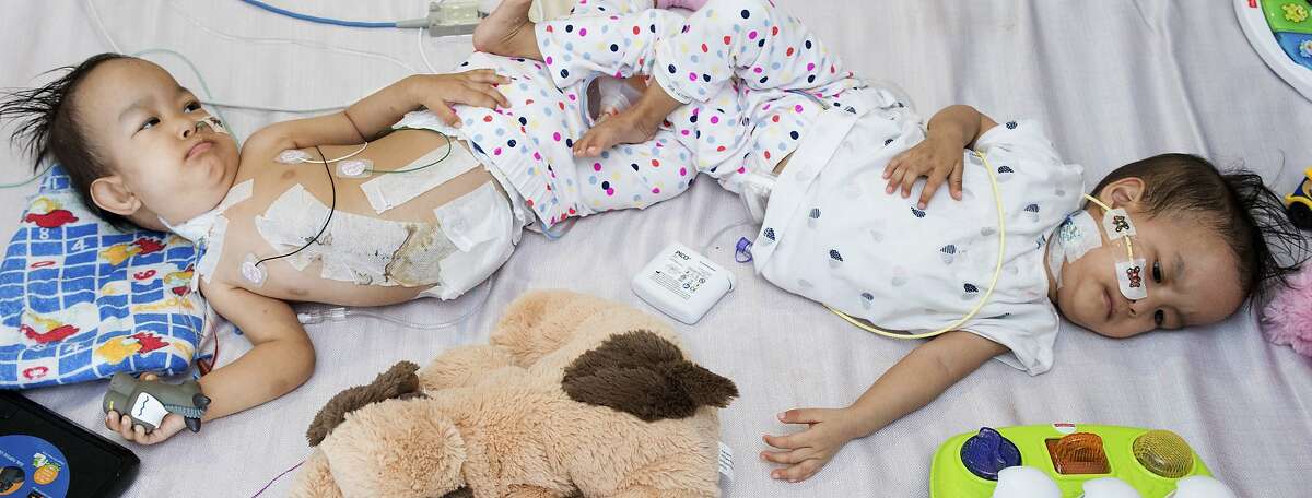 In this Wednesday, Nov. 14, 2018, photo provided by RCH Melbourne Creative Studio, 15-month-old girls, Nima and Dawa lie in their hospital bed following a successful separation surgery last week. The conjoined twins from Bhutan were separated at an Australian hospital Nov. 9, 2018 in a delicate operation that divided their shared liver and reconstructed their abdomens. (The Royal Children's Hospital Melbourne Creative Studio via AP)