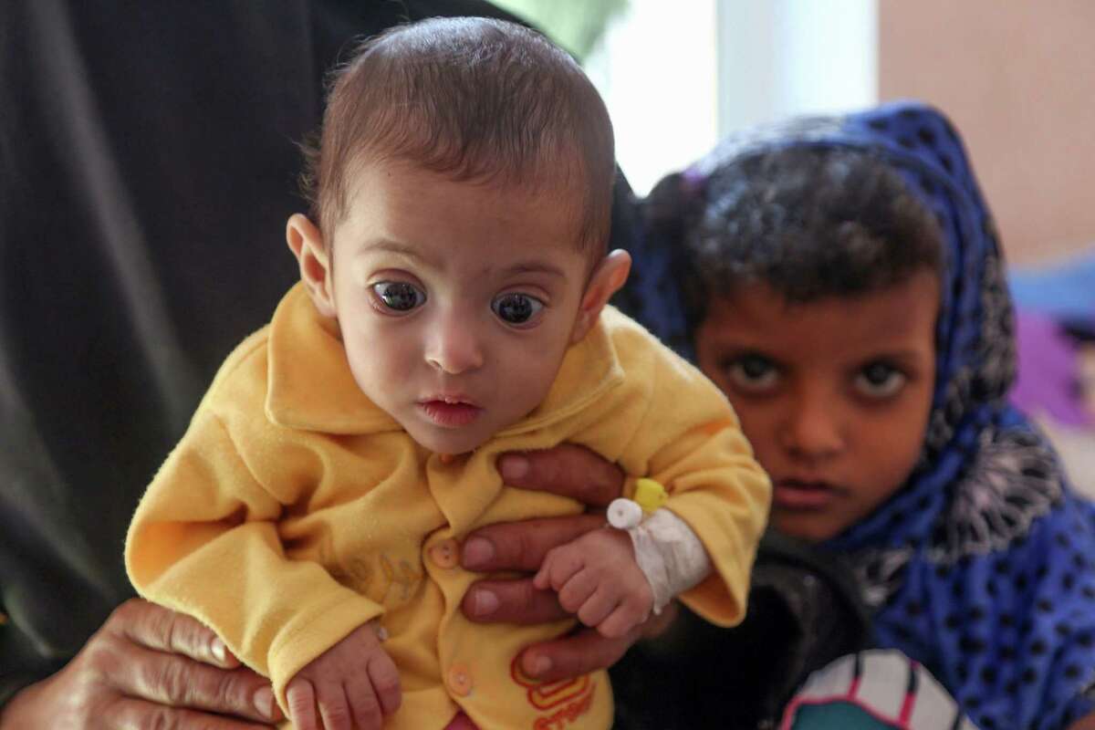A Yemeni child suffering from malnutrition is seen being held by a woman at a treatment centre in a hospital in the country's third-city of Taiz. on November 21, 2018. - As many as 85,000 infants under the age of five may have died from starvation or disease since 2015 in war-ravaged Yemen, humanitarian organisation Save the Children said on November 21, basing its estimate on UN-compiled data, which has warned that up to 14 million people are at risk of famine in Yemen where Saudi-backed forces are battling Iran-aligned Huthi rebels.