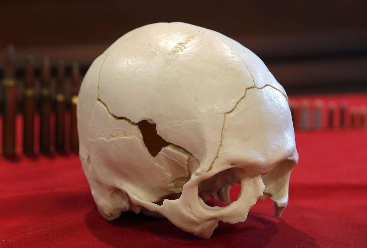 A plastic cast of a gunshot victim’s skull is displayed at pathologist Dr. Judy Melinek’s office in San Francisco, Calif. on Tuesday, Nov. 13, 2018. Dr. Melinek's response to an NRA comment that doctors should "stay in their lane" regarding gun violence went viral after she tweeted it on Friday.