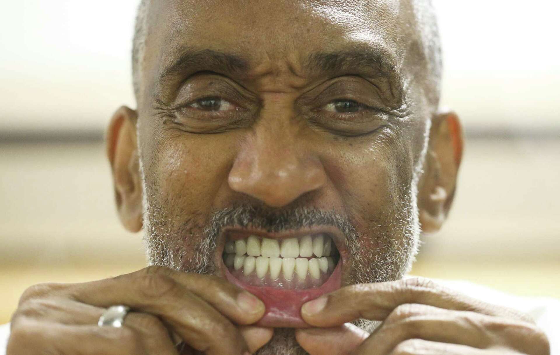 Texas prisons to start 3D-printing dentures for toothless inmates