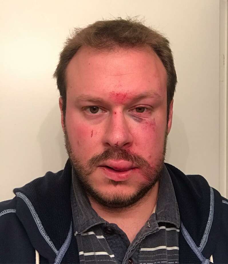 Photographer says he was assaulted, robbed while photographing SF