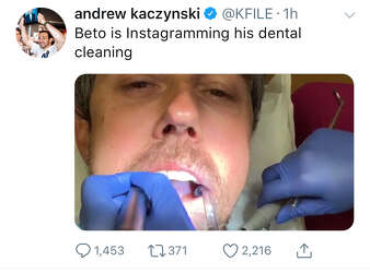 Beto Getting Teeth Cleaned